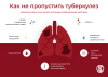 ОСТОРОЖНО ТУБЕРКУЛЕЗ